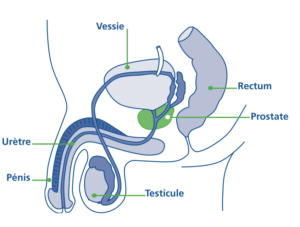 Cancer du testicule : je comprends sa découverte et son évolution